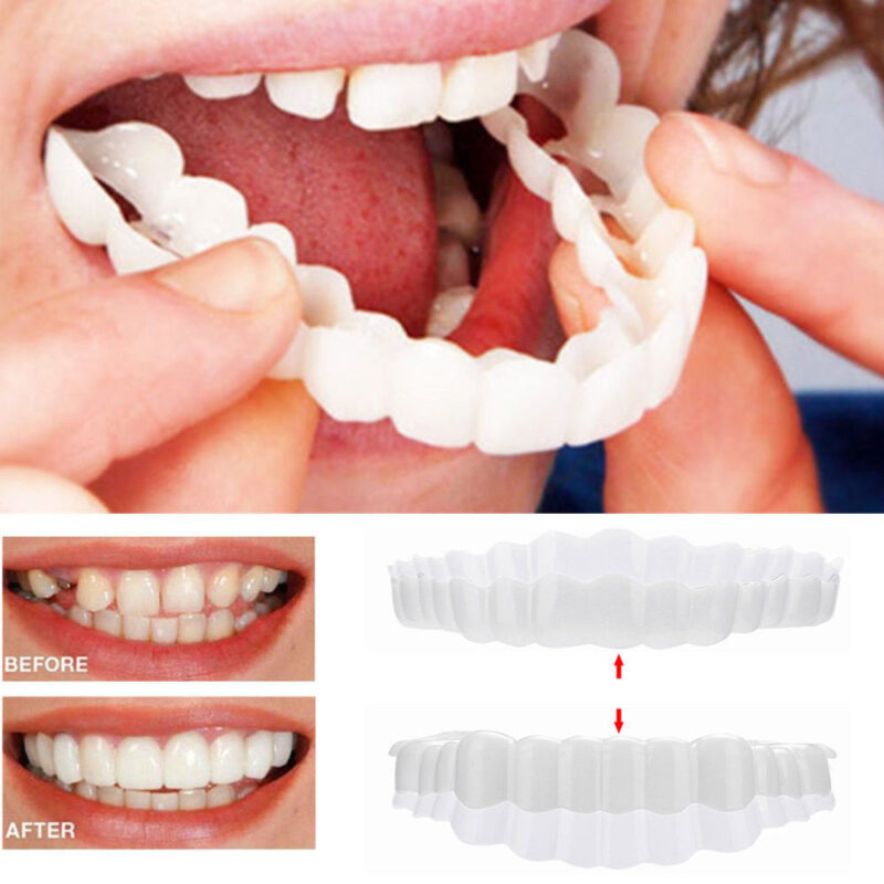 Xshopz Perfect Instant Smile Teeth Veneers Uppers Lowers