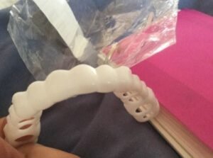 Snap-On Smile Teeth Veneers photo review